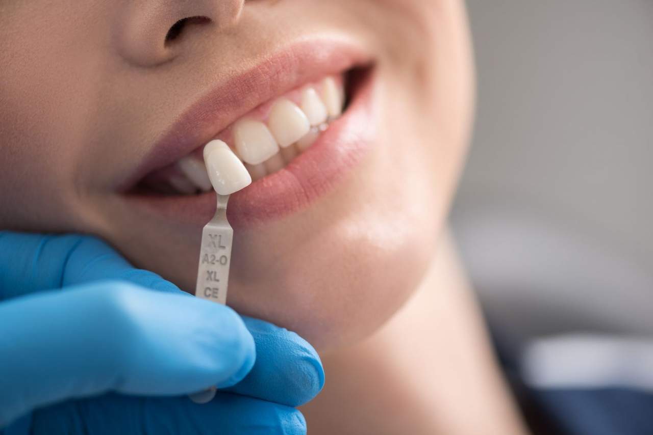 Clínica dental Helident en Sevilla: los implantes dentales en Sevilla