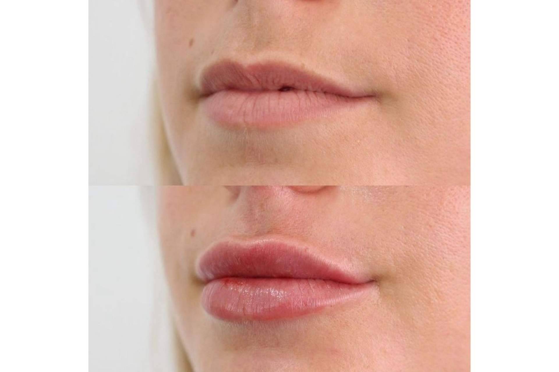 ¿Es posible revitalizar la expresión facial de mujeres y hombres mediante tratamientos estéticos?: Doctor Castellar