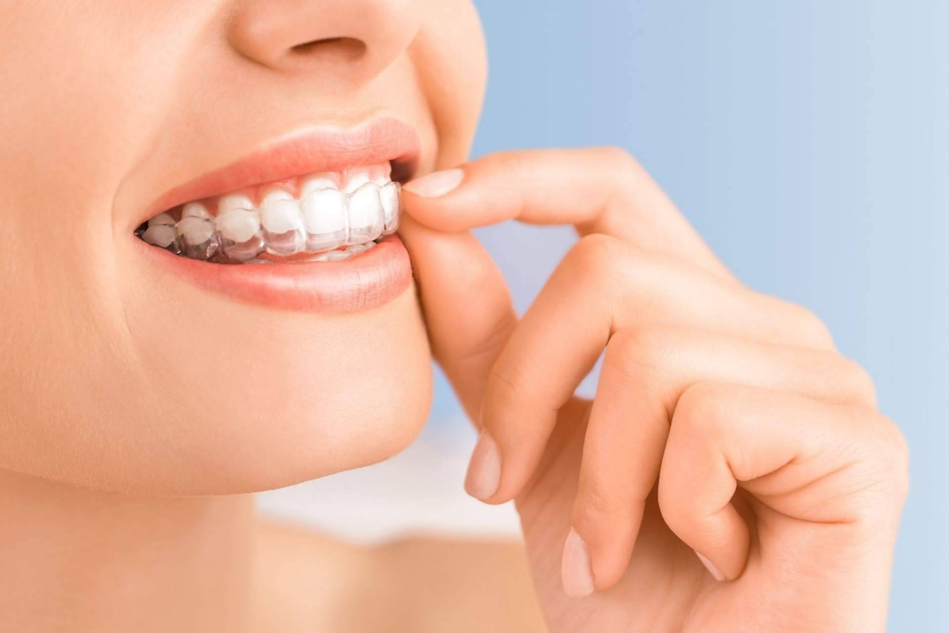 ¿La estética dental ofrece un efecto rejuvenecedor? Clínica Viasalud