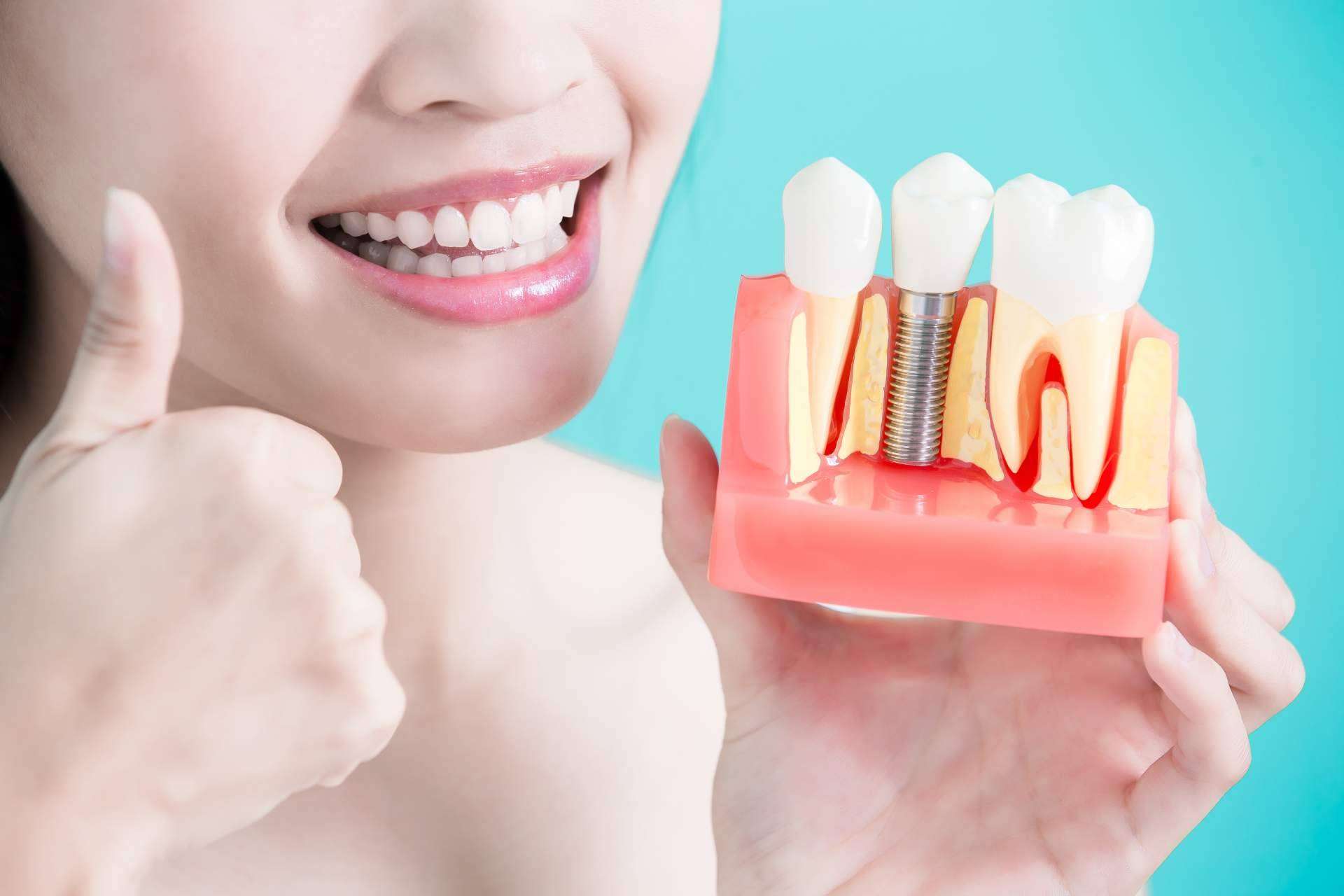 ¿Cuánto cuesta un implante dental?: implante dental en Valladolid por Clínica Dental Heins