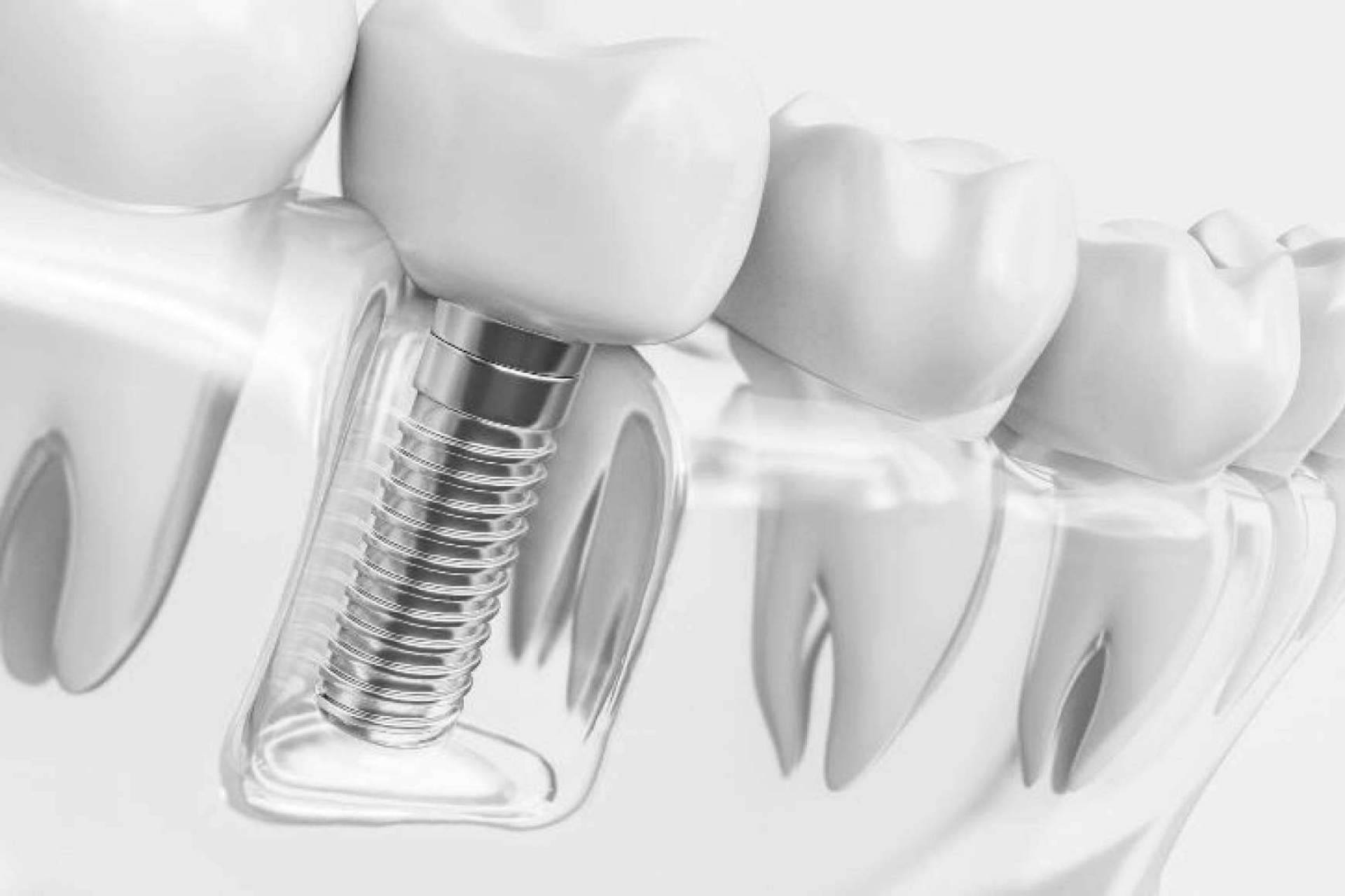 Tratamientos de calidad de ortodoncia invisible con Grupo Gente Vital