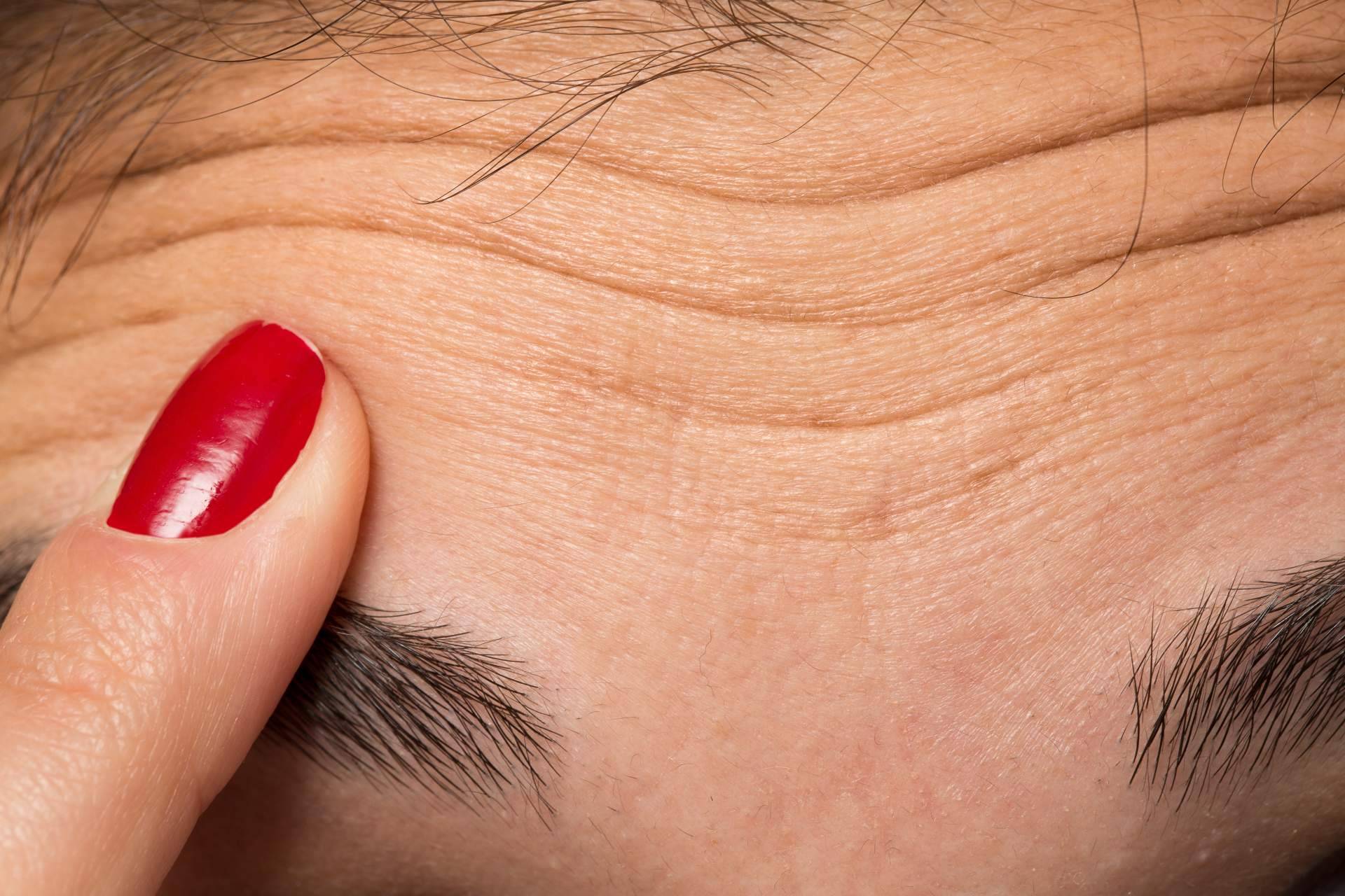 Diseño de cejas con bótox en Castellón de la mano de la Clínica de Medicina Estética Sánchez Peral