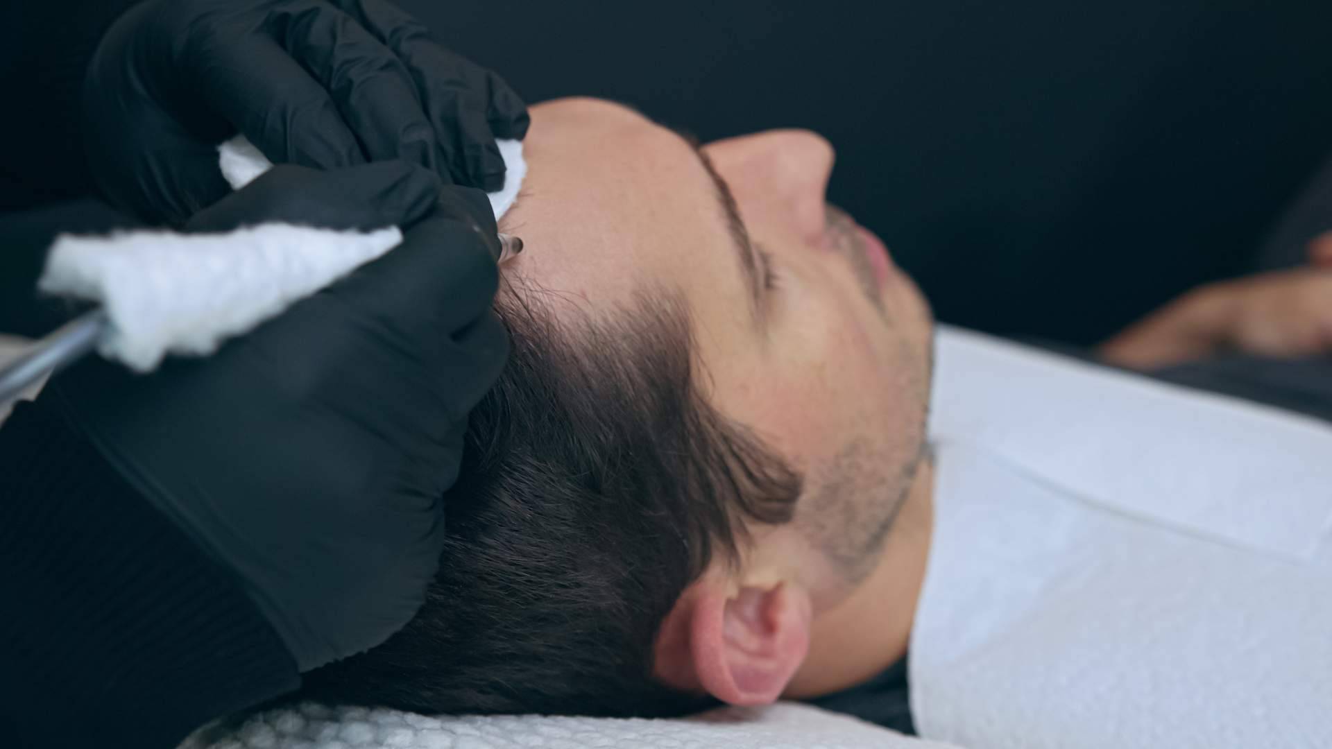 Las Clínicas Dr. Pelo ofrecen tratamientos de micropigmentación con efecto de redensificación