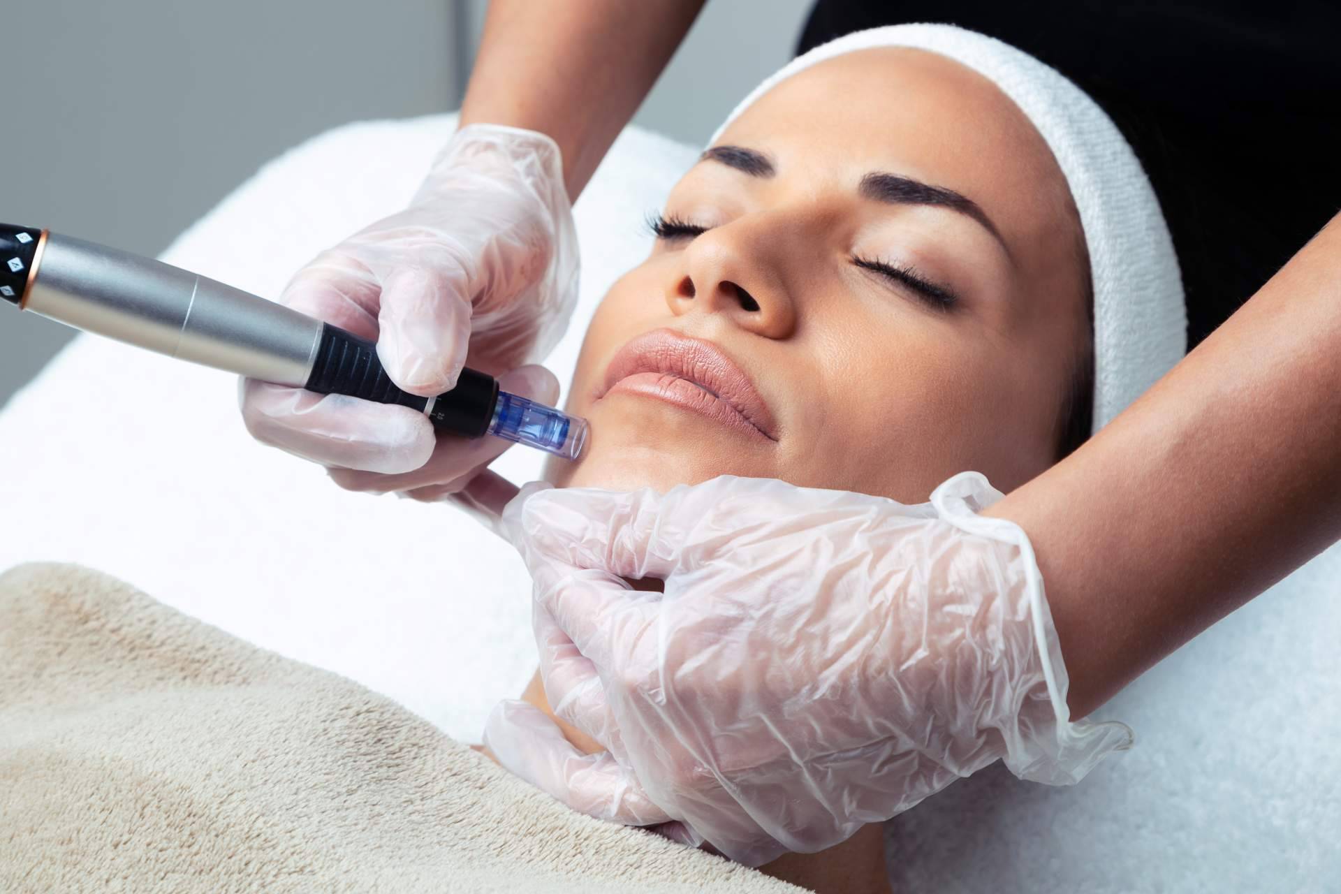 Tratamiento de mesoterapia BIO para rejuvenecer la piel y activar su regeneración en la Policlínica ICD