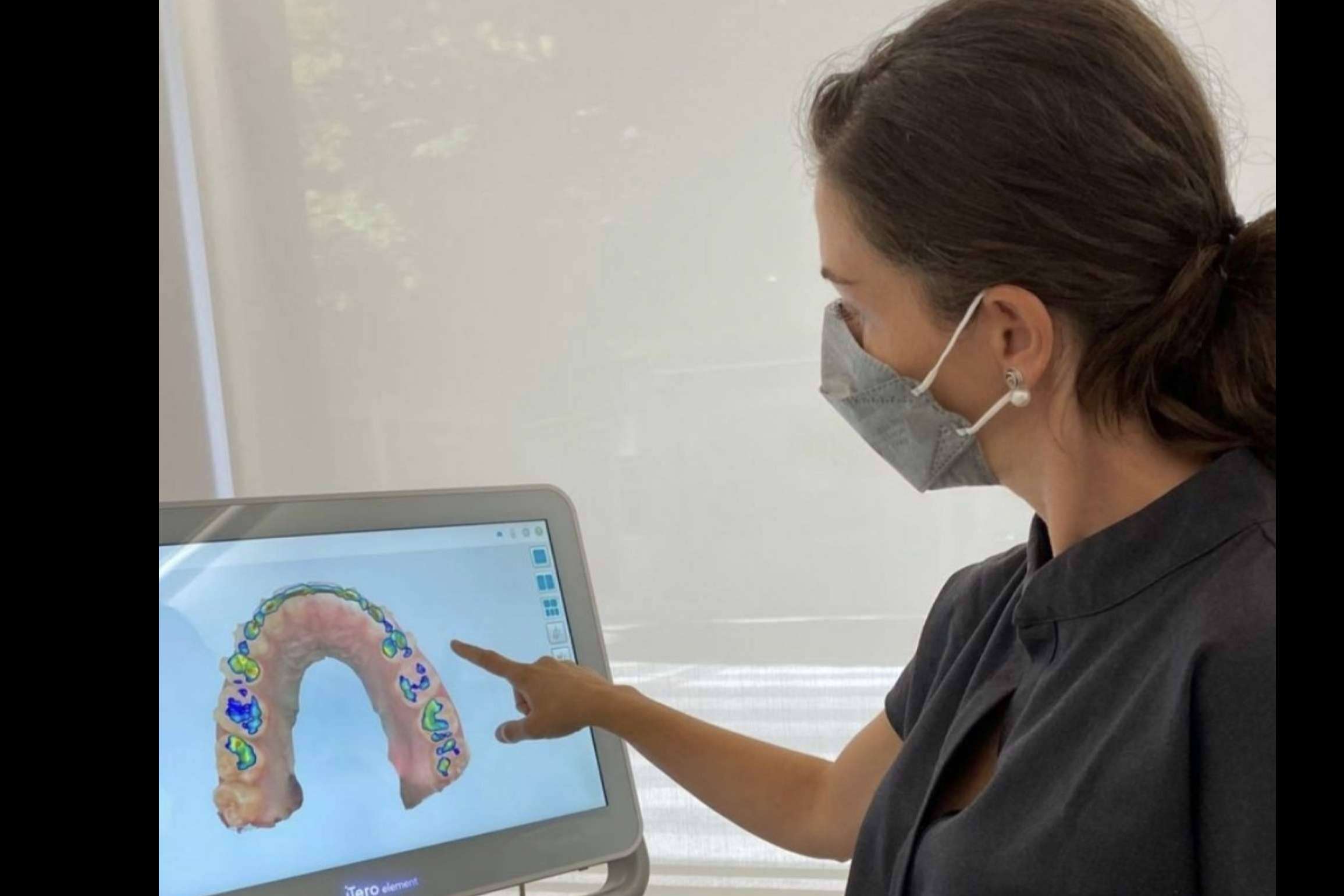 Clínica dental Carmen Díaz proporciona las ventajas que ofrece el tratamiento Invisalign