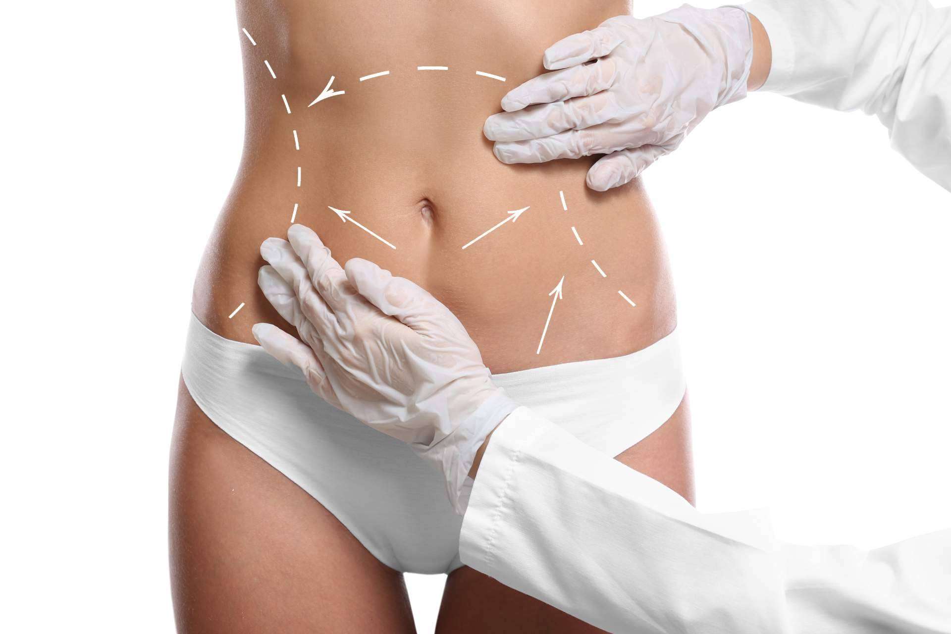 Mave Medicina Estética en Zaragoza realiza cirugías de liposucción para remodelar la figura