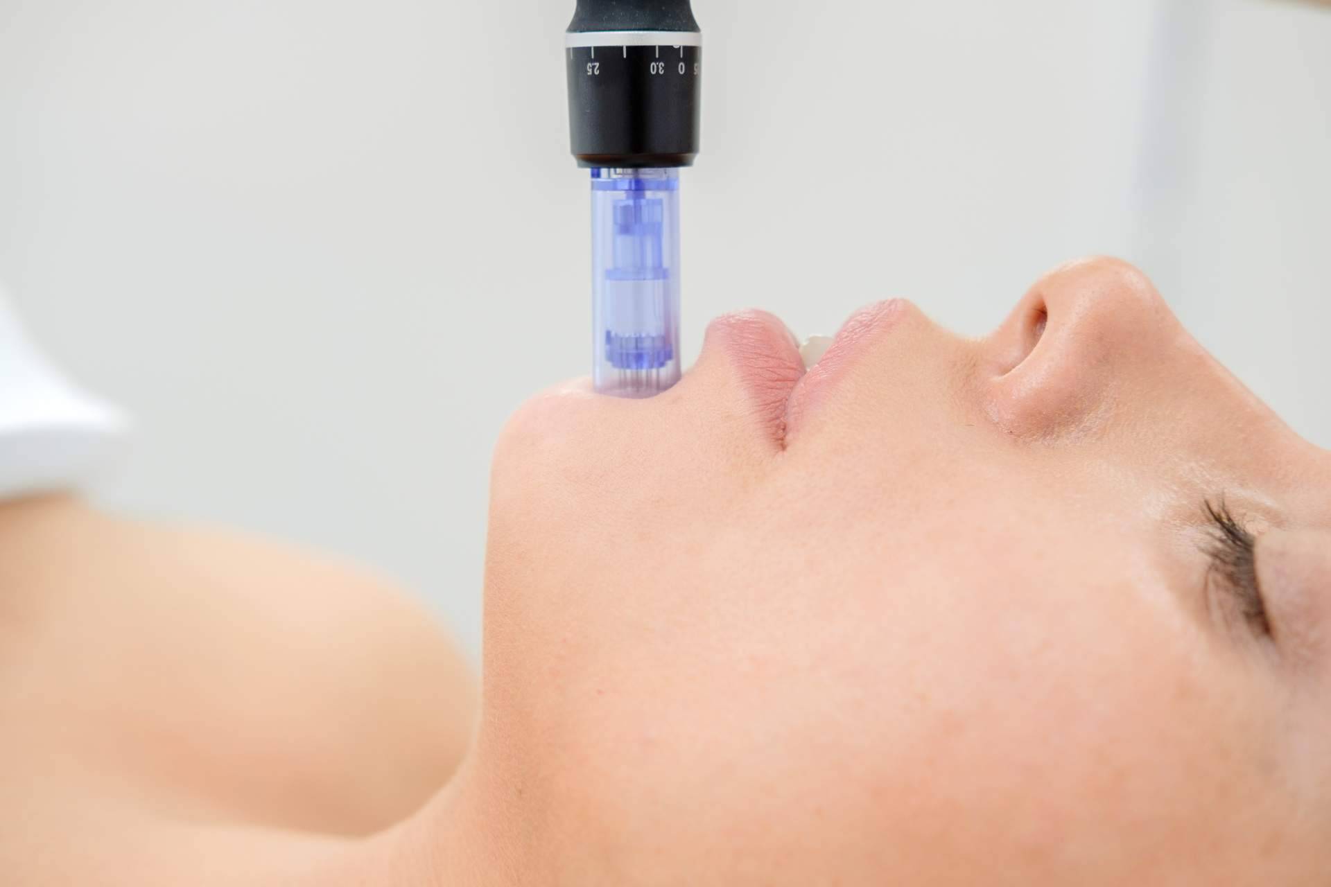 Tratamientos faciales de Policlinica ICD, una alternativa para preparar el rostro esta primavera