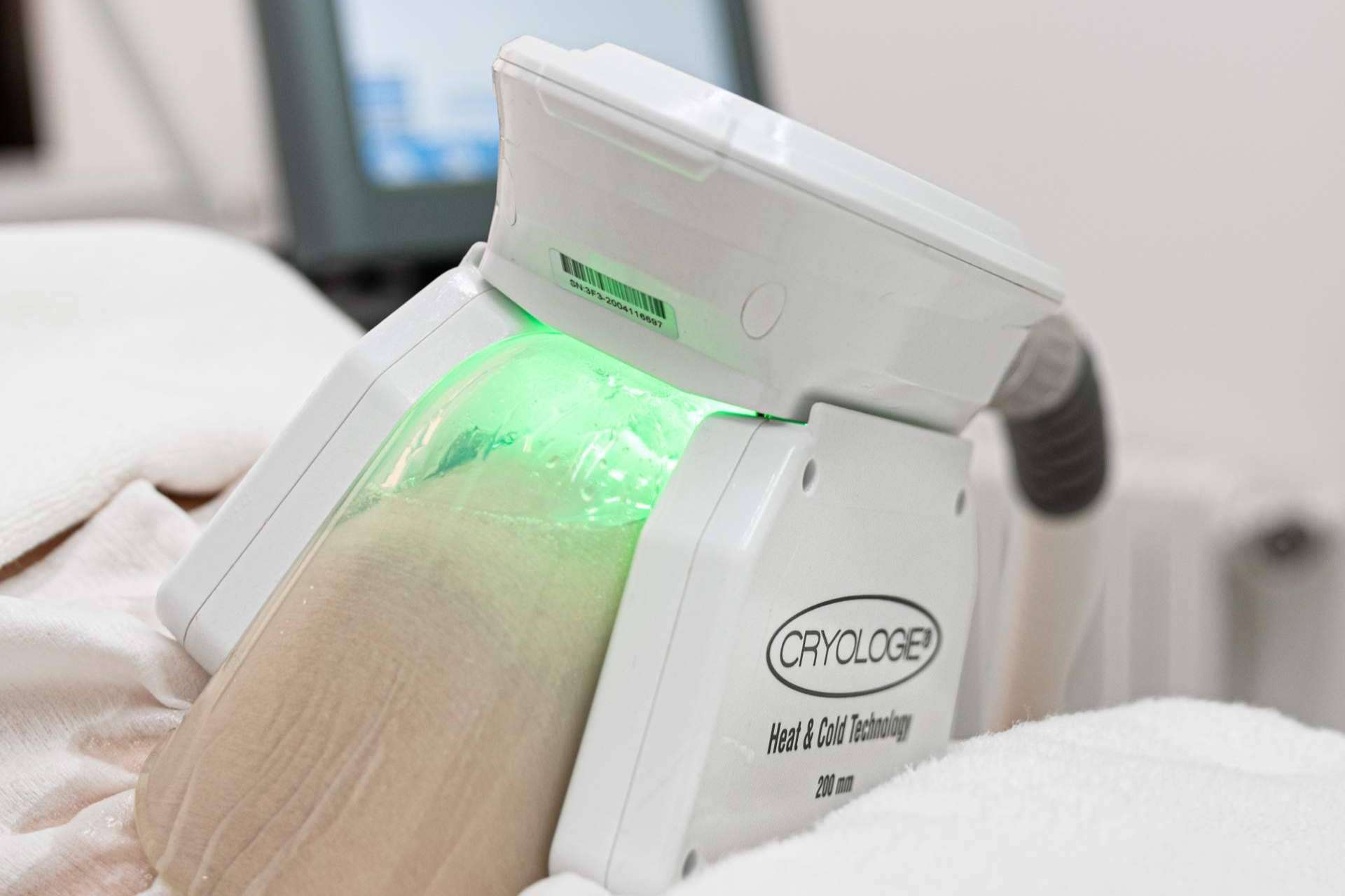Reducir la grasa localizada con tratamientos combinados de criolipólisis y estimulación electromagnética