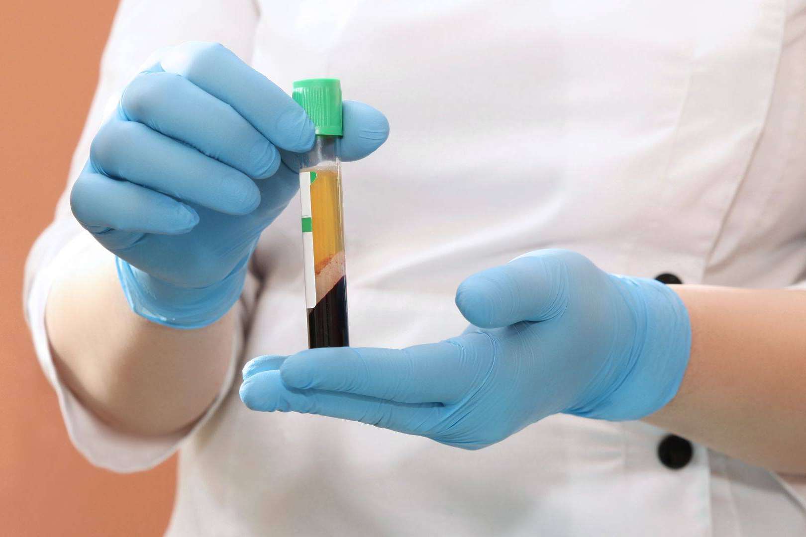 Plasma rico en plaquetas y dutasterida, la potente terapia regenerativa de doble efecto contra la caída del cabello