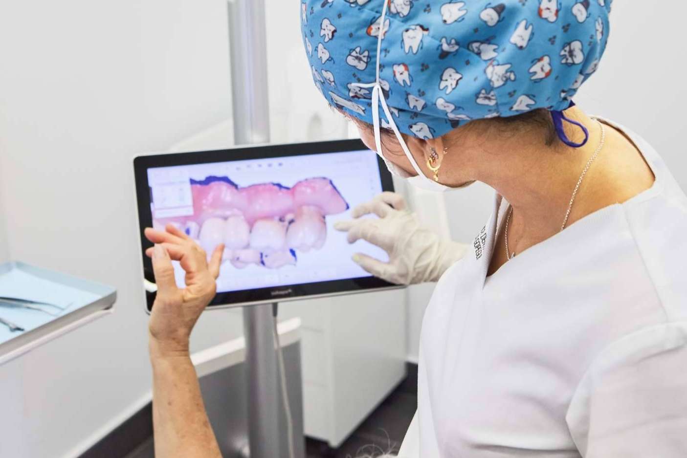Las ventajas de realizarse un diseño de sonrisa en la Clínica Dental Ruiz de Gopegui