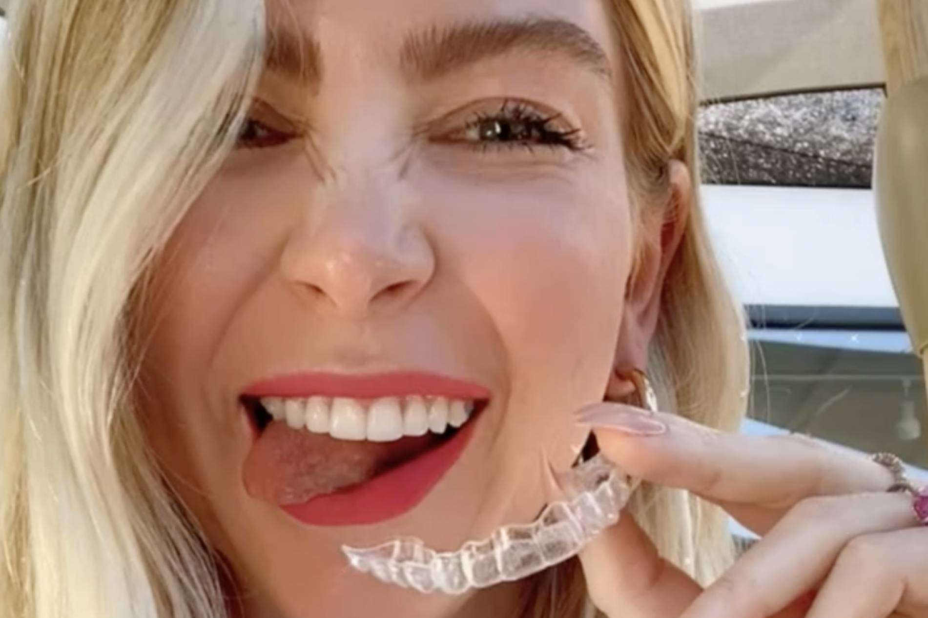 Clínica Dental Ruiz de Gopegui ofrece un precio especial para los pacientes que quieran la ortodoncia invisible Invisalign